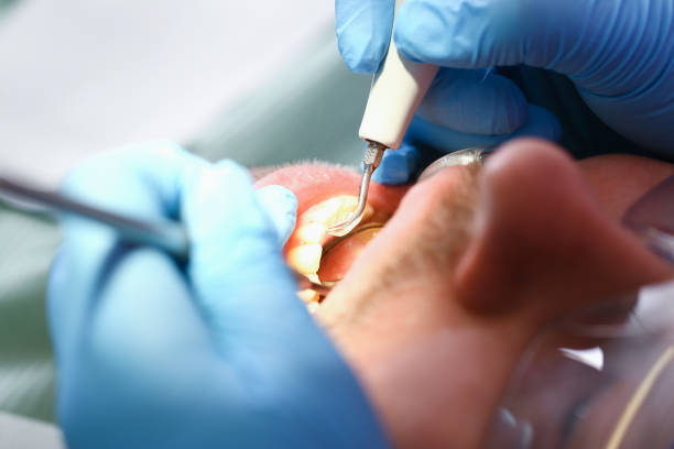 Best Emergency Dental Care for Abscessed Tooth in Buckhall, VA