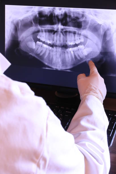 Best Emergency Root Canal Treatment in Buckhall, VA