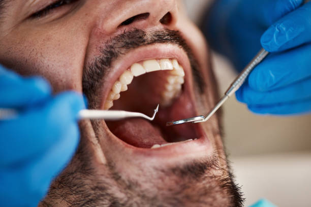 Best Pediatric Emergency Dentist in Buckhall, VA