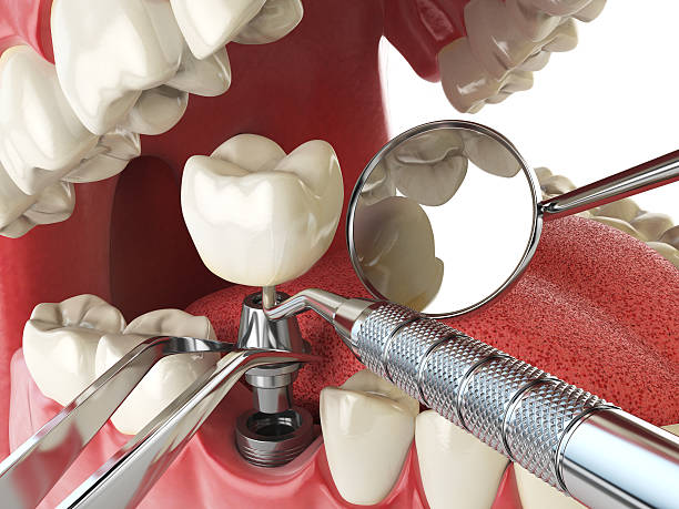 Best Emergency Dental Care for Abscessed Tooth in Buckhall, VA
